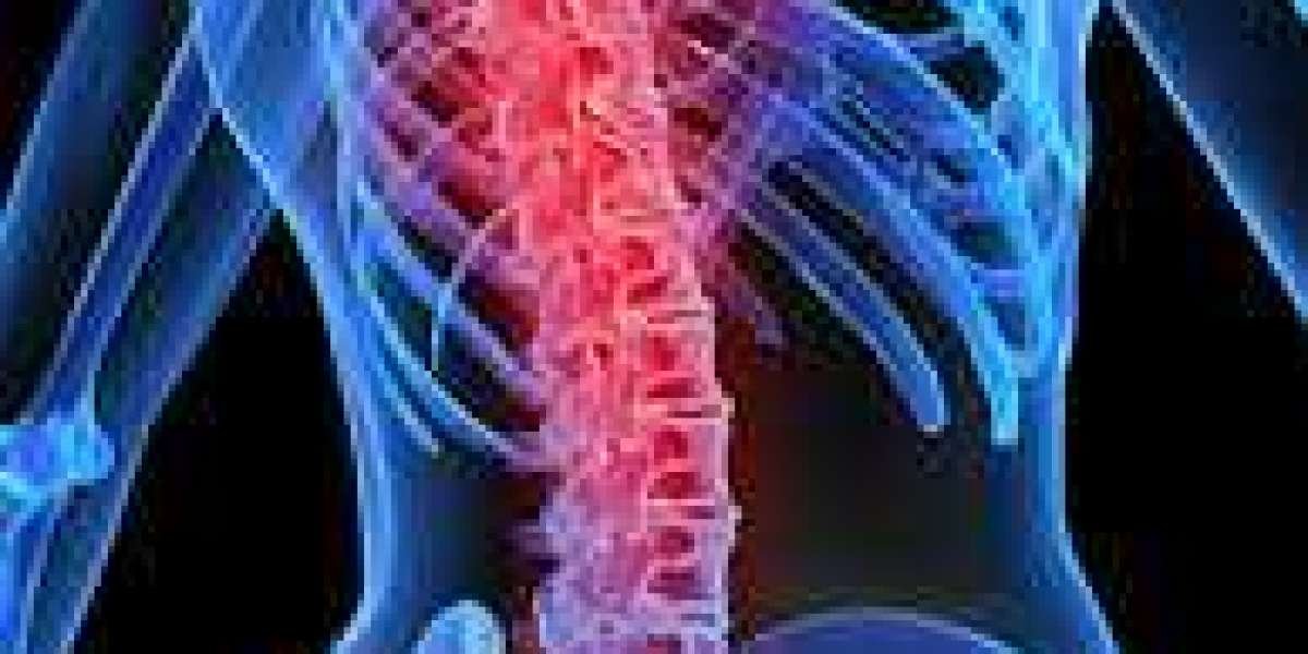 Acute Spinal Cord Injury Market Demand, Growing Trends, Top Players Analysis and Regional Forecast by 2030