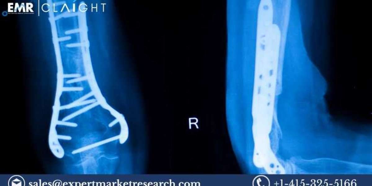 Global Medical Implant Market Size, Share, Trends, Growth, Analysis, Report, Forecast 2024-2032