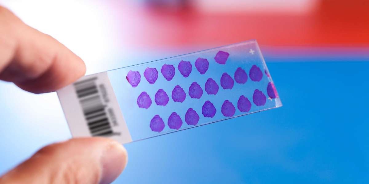 Tissue Microarray Market Insights: Industry Grows Incredibly; Confirms MRFR