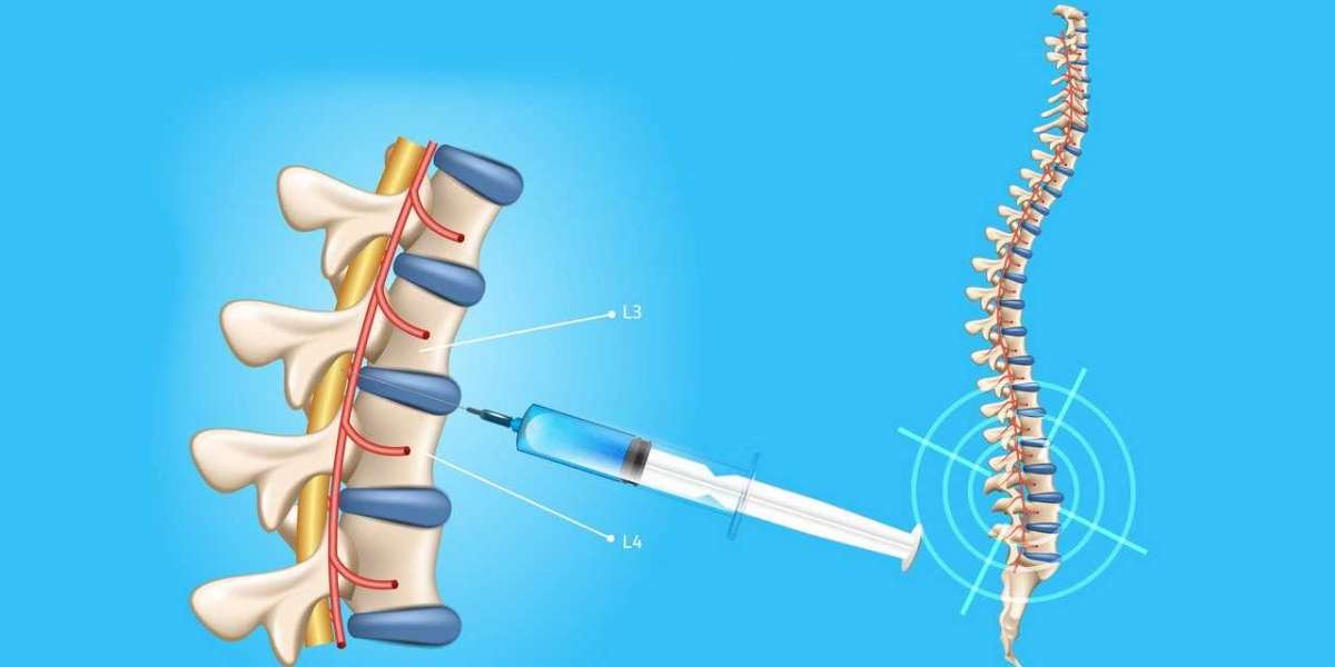 Spinal Needles Market Insights on Drivers and Restraints Impacting the Global Industry