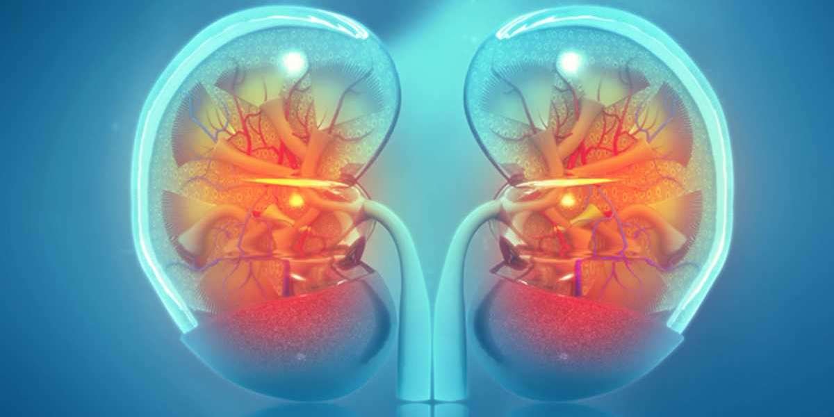 Nephritis Market Demand, Growth, Trend, Business Opportunities, Manufacturers and Research Methodology by 2032