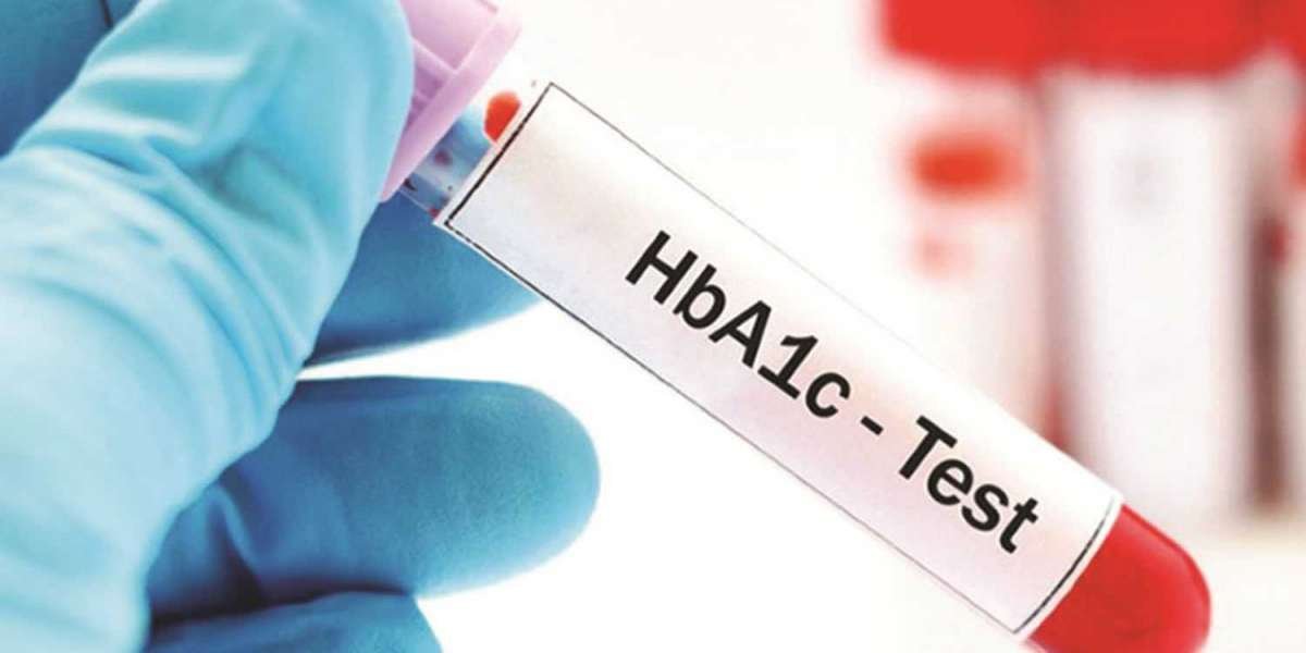 HbA1c Testing Market Insights Report & Forecast to 2030 - Industry Analysis, Scope, Stake, Progress & Trends