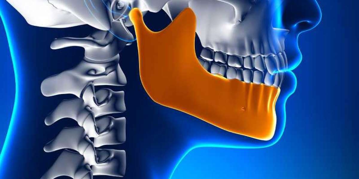 Global TMJ Implants Market Insights on Industry Size, Share & Growth