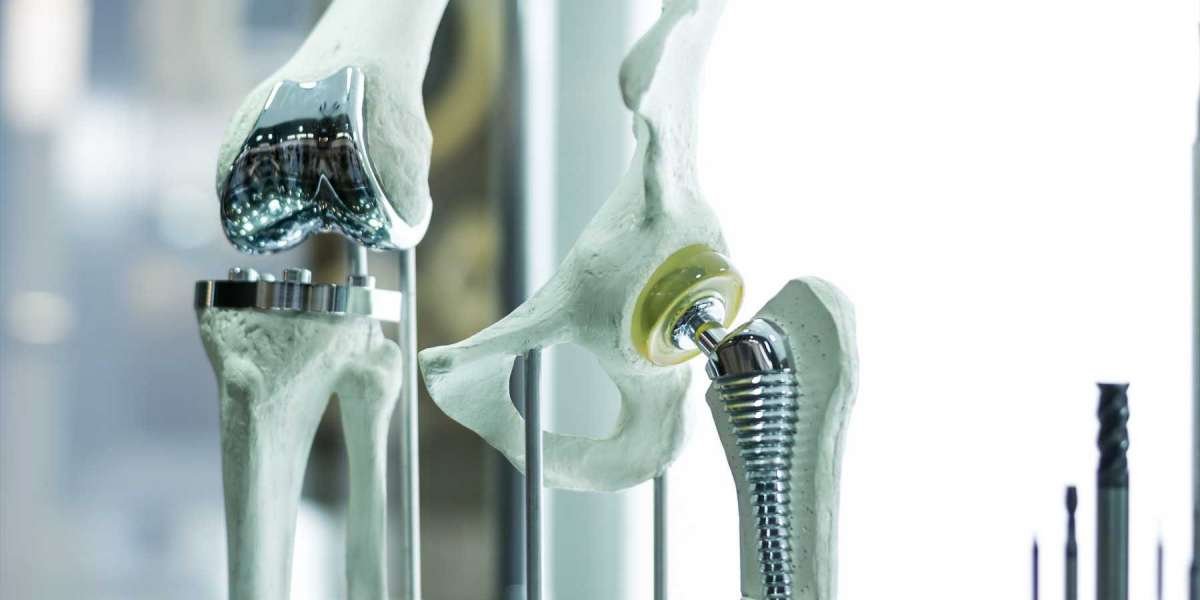 Releasing of New Products Have Spur the Industry; Claims The America Orthopedic Biomaterial Market Insights Report