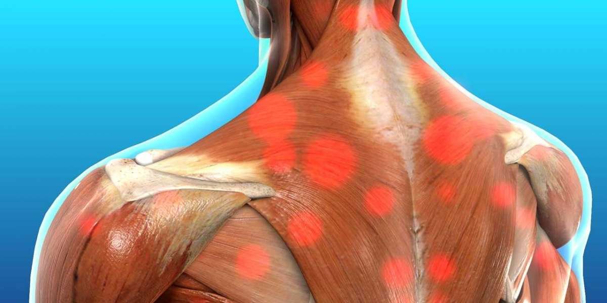 Upper Back and Neck Pain: A Comprehensive Guide
