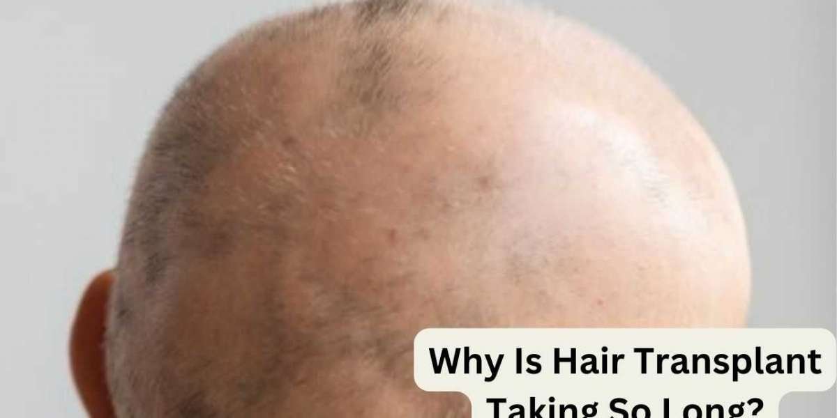 Why Is Hair Transplant Taking So Long?
