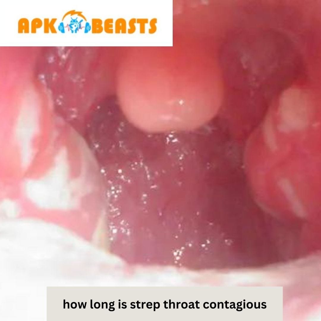How Long Is Strep Throat Contagious? | by Apk Beasts | Feb, 2024 | Medium