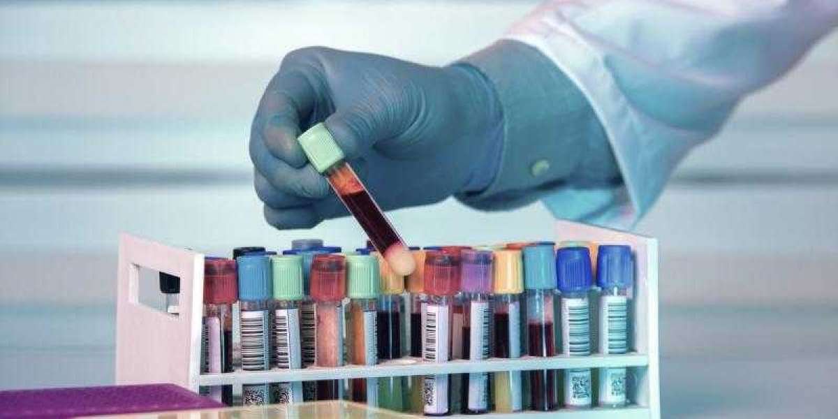 Biobanking Market Share, Trends, Growth, Report and Forecast 2024-2032