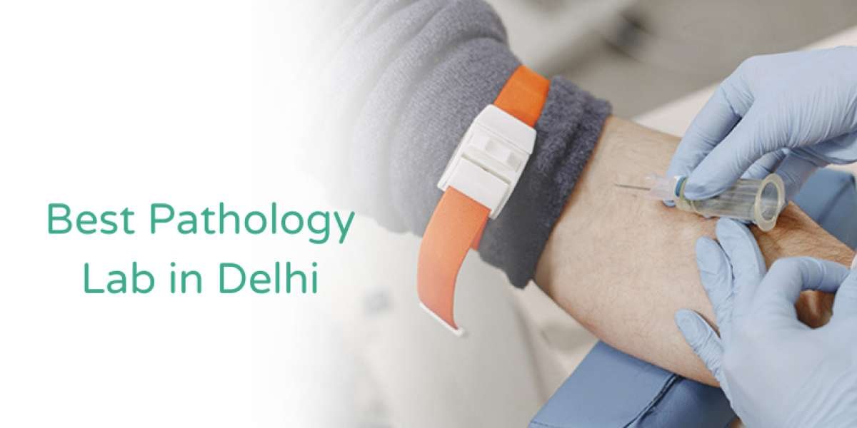 Best Pathology Lab Services in Delhi | Mahajan Imaging & Labs