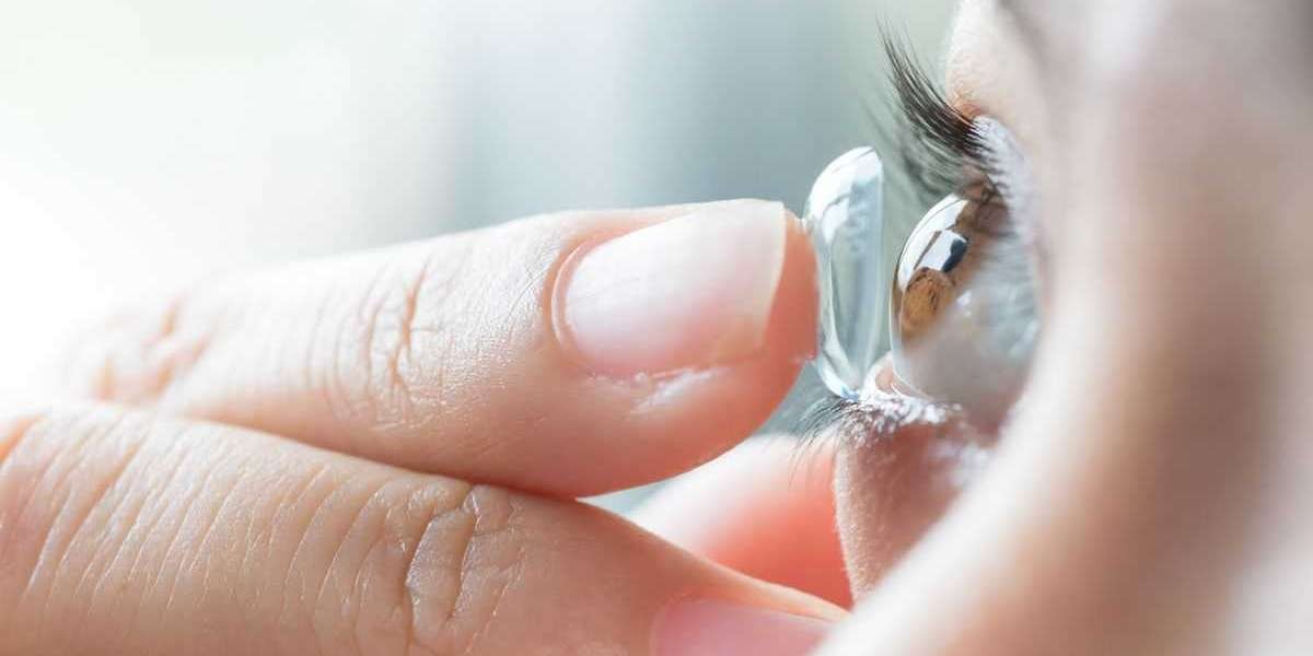 What You Need to Know About Contact Lenses