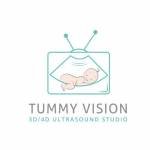 Tummy Vision 3D/4D Ultrasound  Gender Reveal