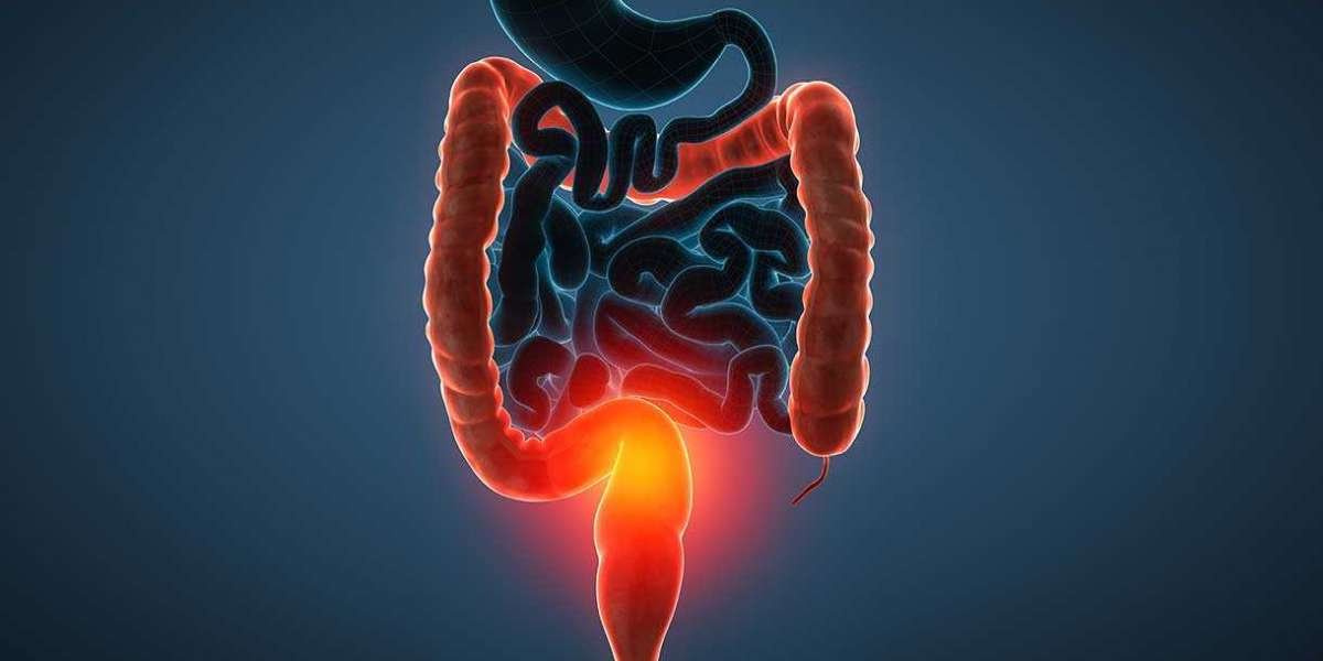 Salix Pharmaceuticals' XELJANZ XR: A New Frontier in Ulcerative Colitis Treatment