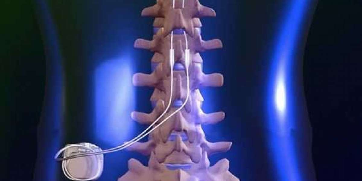 Spinal Pumps Market is Expected to Gain Popularity Across the Globe by 2030