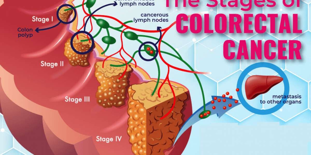 Panitumumab Market 2024 Analysis Key Trends, Growth Opportunities, Challenges, Key Players, End User Demand and Forecast