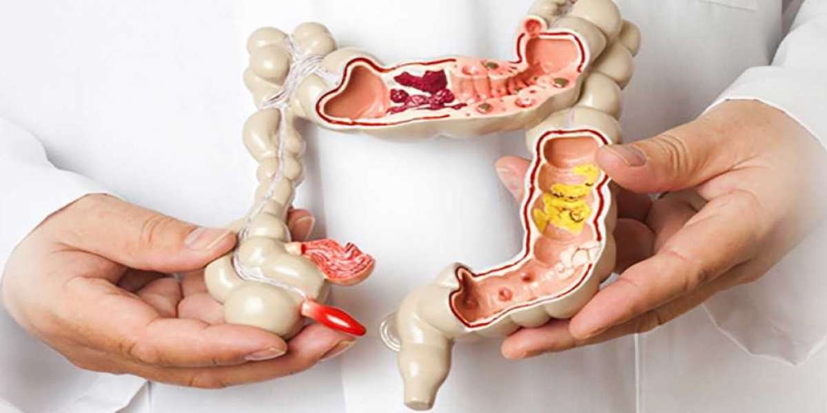 How Mumbai Best Consultant Colorectal Surgeon Mumbai Can Change Your Life