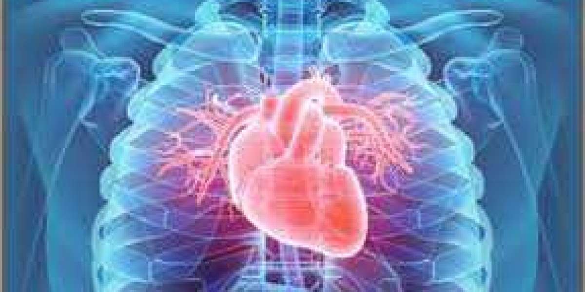 Cardiovascular Medical Laser Market Share : Quarterly | By Dataintelo