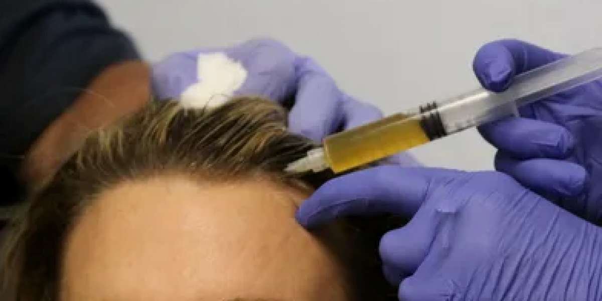 How Plasma Injection Therapy Can Improve Hair Quality in Abu Dhabi