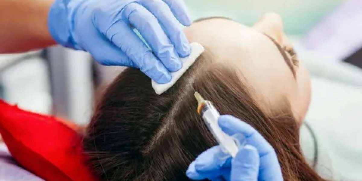 How Plasma Injection Therapy Can Improve Hair Quality in Abu Dhabi