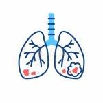 LungCancerTreatmentHospitals Bangalore